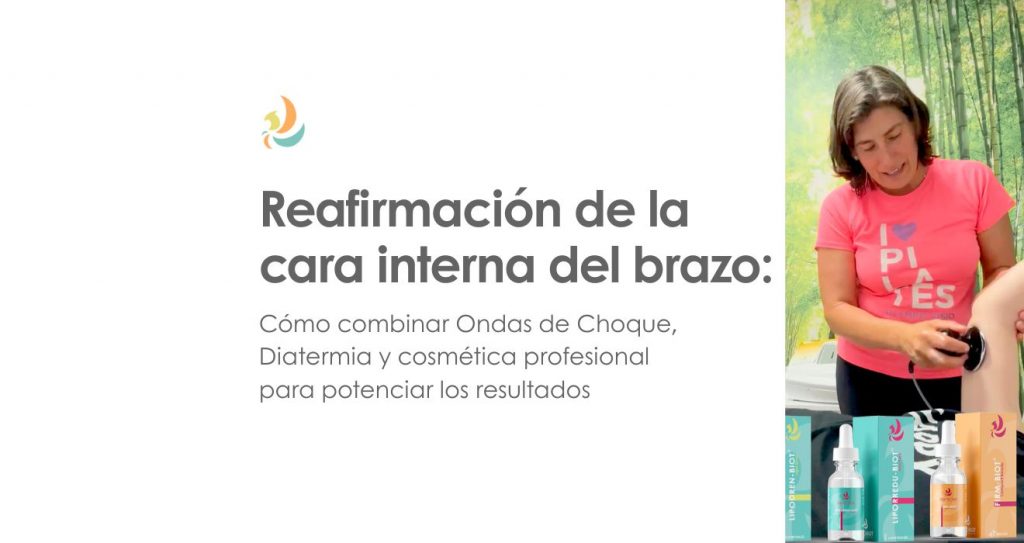 Reafirmación de la cara interna del brazo: cómo combinar Ondas de Choque, Diatermia y cosmética profesional para potenciar los resultados