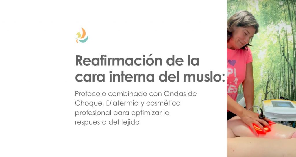 Reafirmación de la cara interna del muslo: protocolo combinado con Ondas de Choque, Diatermia y cosmética profesional para optimizar la respuesta del tejido